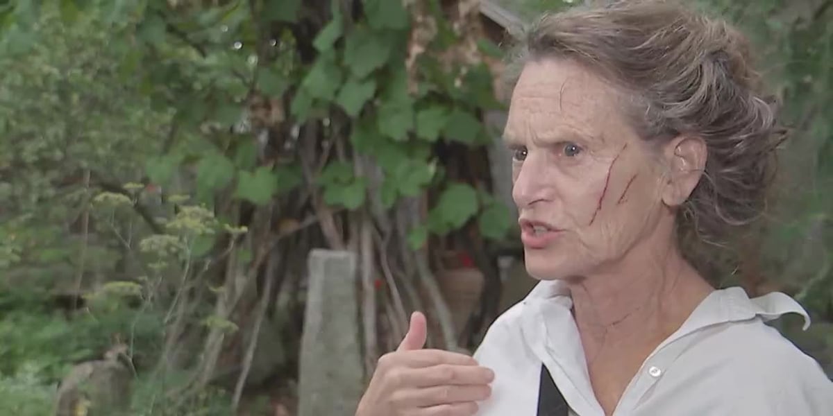 ‘I just encountered a monster’: Woman viciously attacked by raccoon on her back deck