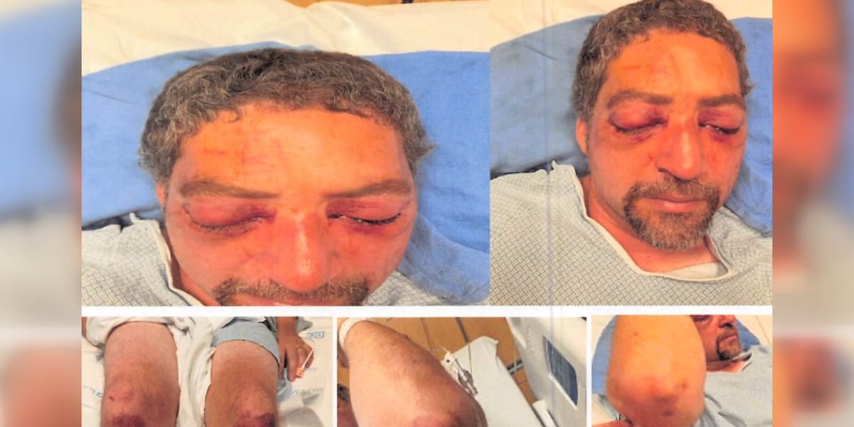 Victim of random road rage attack may need to have both eyes removed ...