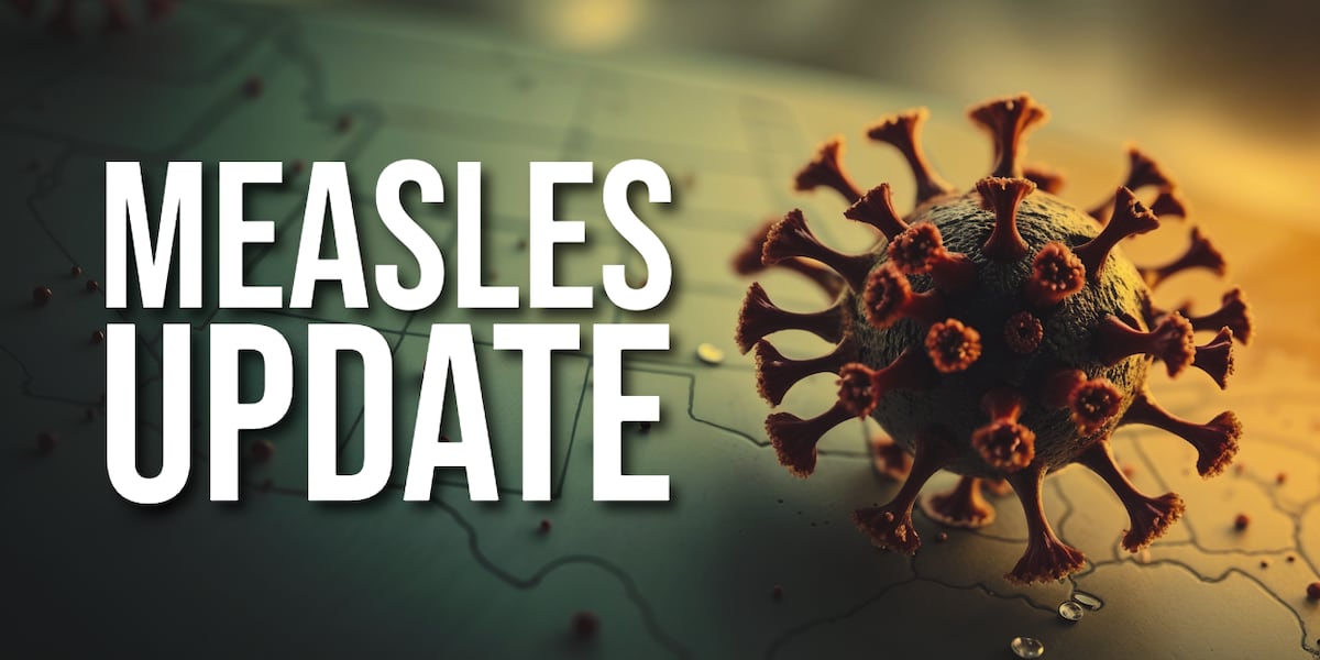 First cases of measles in Wisconsin confirmed