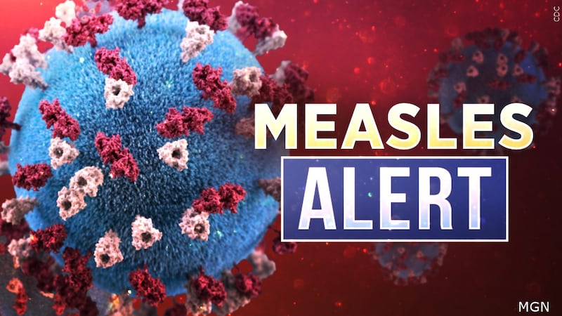 Two confirmed cases of measles in Jackson County