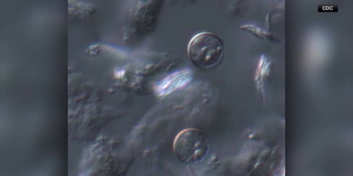 Cyclosporiasis outbreak linked to lettuce expands to 15 states